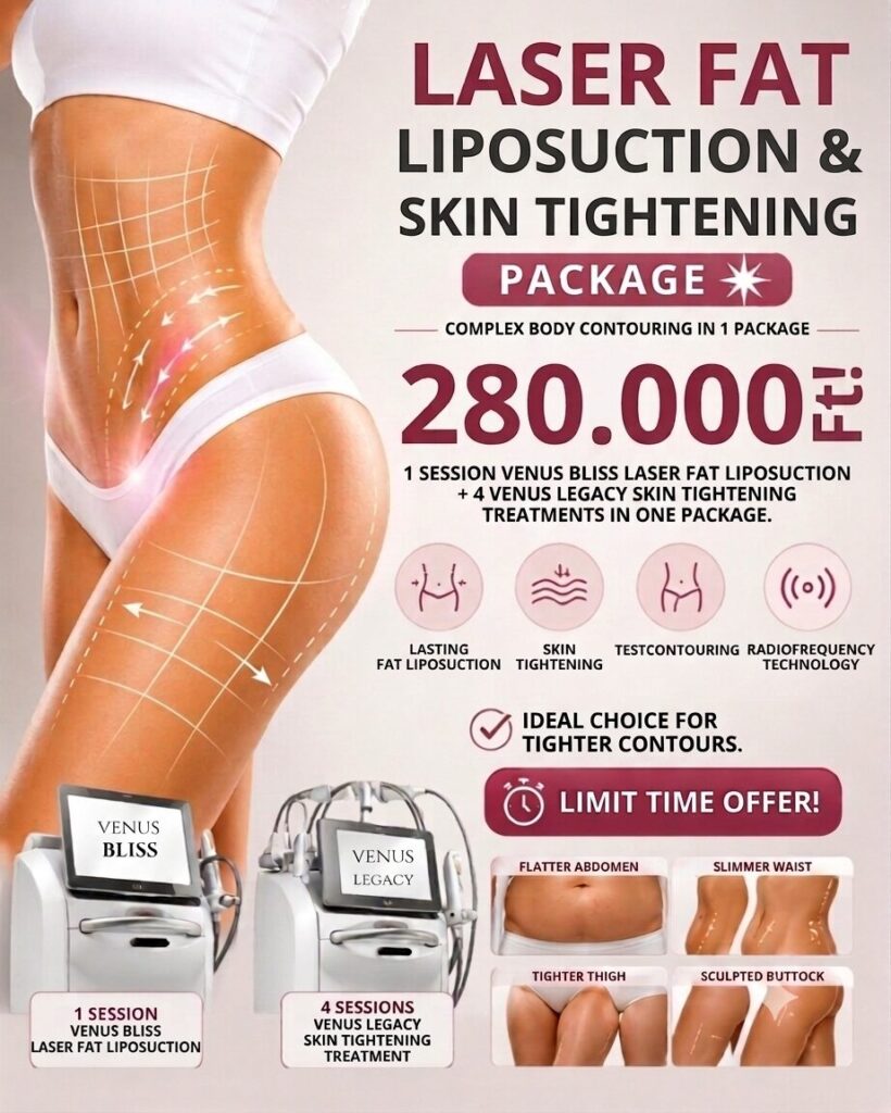 Venus package