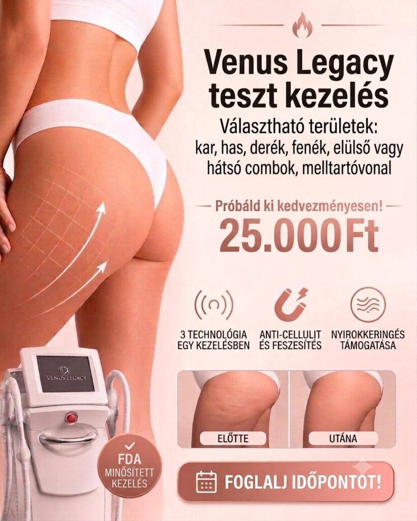 Venus Legacy probakezeles